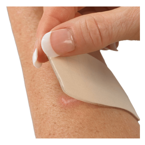 Prevention and Treatment of Adherent Scars